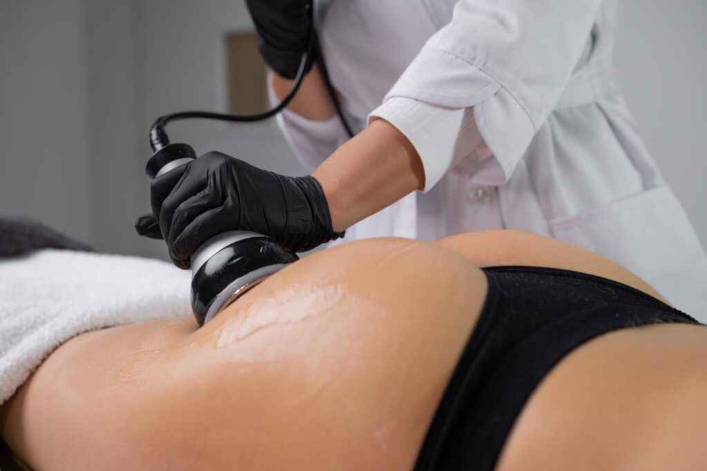 Grasa localizada vs. celulitis: Diferencias, causas y tratamientos avanzados en Phi Belleza Natural.