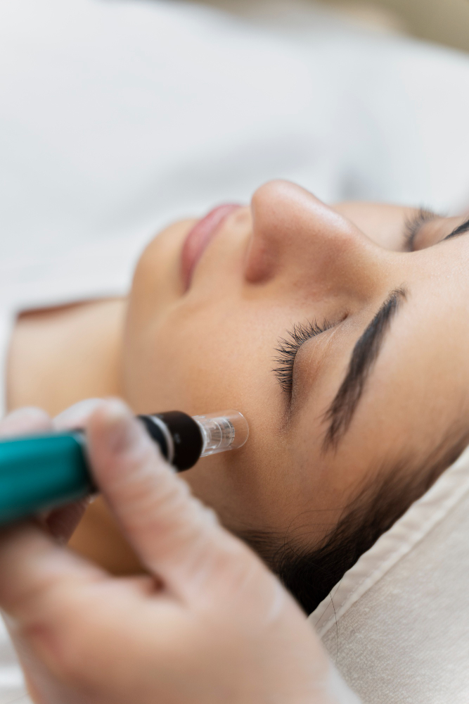 Manchas en la cara: cómo quitarlas en Sevilla. En Phi combinamos Peeling, Micropen e Infinity Glow para un tono uniforme. Agenda tu valoración.