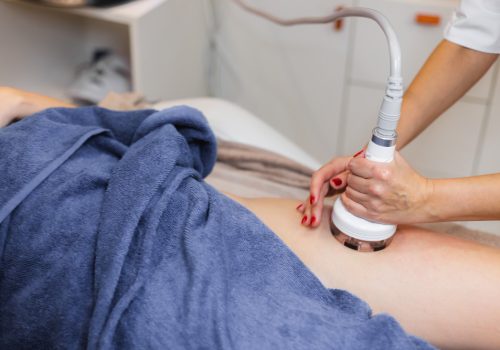 Criolipolisis en Sevilla, tratamiento corporal. Centro de Estética Phi Belleza Natural.