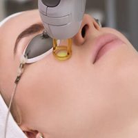 Láser Nano Yag rejuvenecedor en Sevilla. Centro de Estética Phi Belleza Natural