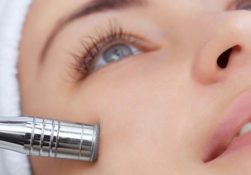 ¿Qué es la microdermoabrasión y qué beneficios tiene? Centro de Belleza en Sevilla con Microdermoabrasión con punta de diamante