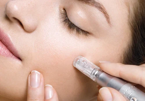 Tratamientos faciales Sevilla BB Glow. Centro de Estetica en Sevilla Phi Belleza Natural.