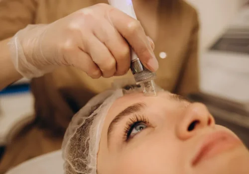 woman-undergoing-procedure-of-vacuum-hydro-peeling-in-beauty-salon